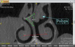 Image Measure