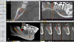 Implantology